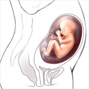 27cc 300x300 Düşük Hapı Düşük iğnesi Bebeği Nasıl Düşürür