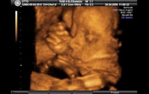 3d11 300x190 Hamileliğin (Gebeliğin) 19. Haftası