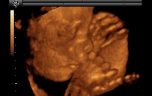 3d13 300x190 Hamileliğin (Gebeliğin) 21. Haftası