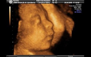 3d15 300x190 Emzirme Döneminde ilaç Sigara Alkol