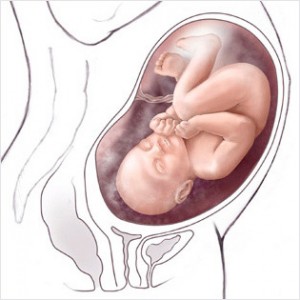 35cc 300x300 Bulantıya Karşı Lezzet İksiri