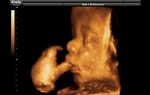 3d1 300x190 Bulantıya Karşı Lezzet İksiri