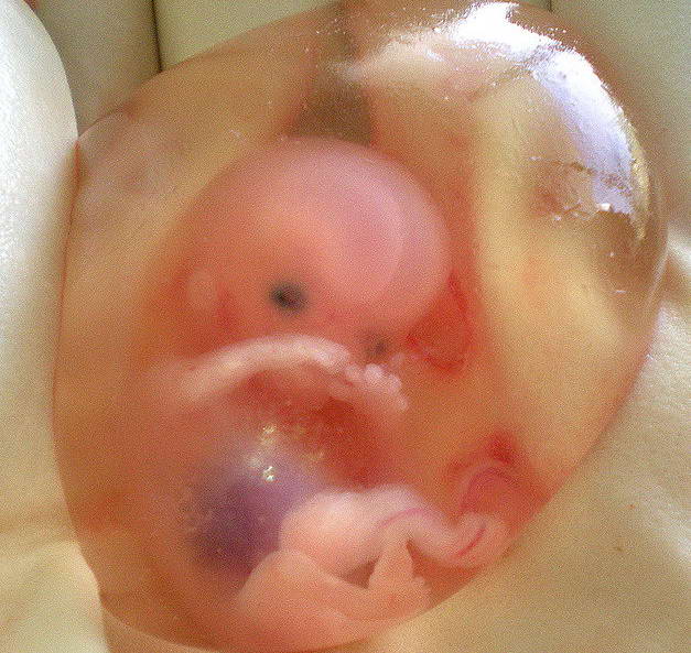 Hamileliğin (Gebeliğin) 10. Haftası - www.hamilelikte.com