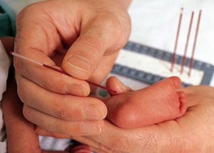 Fenilketonüri – Bebekten Topuk Kanı Alınması
