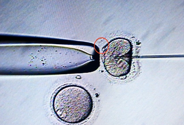 Aşılama (İUİ) nedir – infertilite aşılama yöntemi ve ücreti