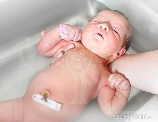 Bebeklerde Göbek Fıtığı Belirtileri Nasıl geçer, Ağrı yapar mı