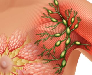 2 Evre Kanser Yaşam Süresi